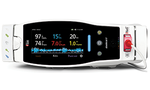 9500 KIT, RADICAL-7 COLOR SCREEN HANDHELD, MASIMO